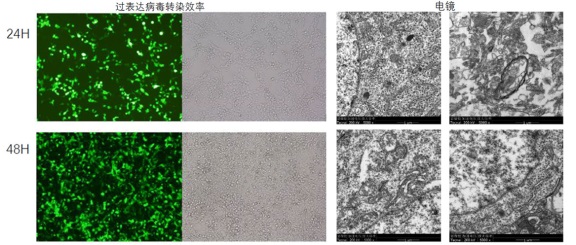 基因A对糖尿病心肌损伤的作用